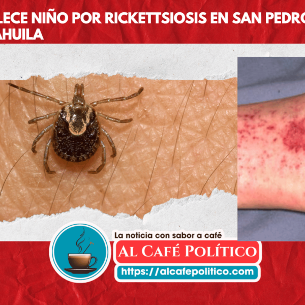 Muere otro bebé por Rickettsia en La Laguna