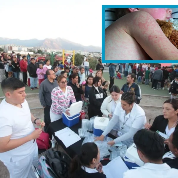 Repunte de sarampión en el norte activa brigadas&hellip;
