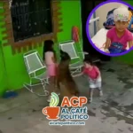Tras 68 puntos y seis horas de cirugía, niña atacada por su perro se recupera en hospital de Monclova